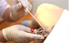 Serviço de corrimentos e HPV